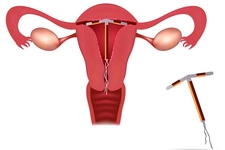 Spiral Yan Etkileri Nelerdir?